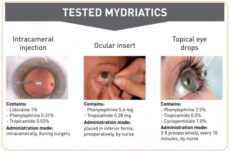 Cataract Surgery & Poor Mydriasis