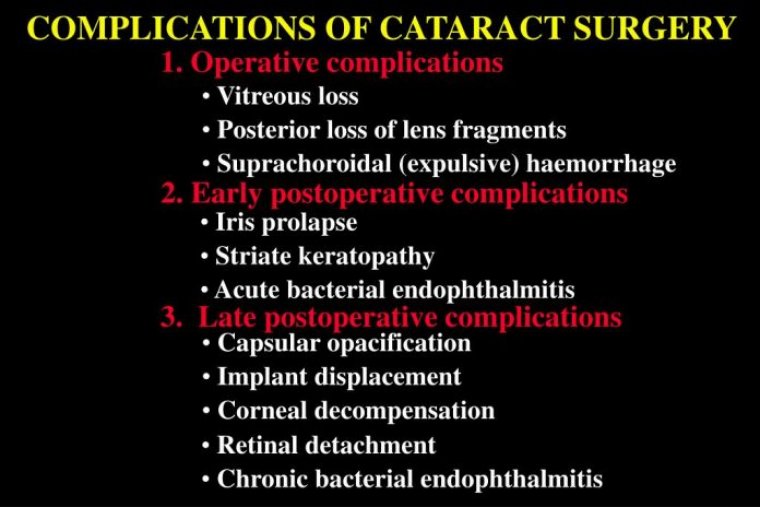 Complications Of Cataract Surgery