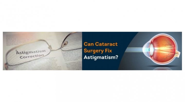 Correcting Pre-existing Astigmatism in Cataract Surgery 