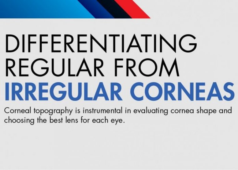 Diagnosing Irregularities In The Corneal Surface Before Cataract Surgery
