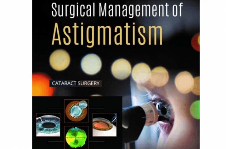 Managing Irregular Astigmatism During Cataract Surgery