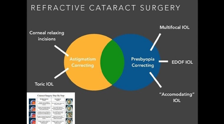 Refractive Cataract Surgery - Patient Needs & IOL Performance 